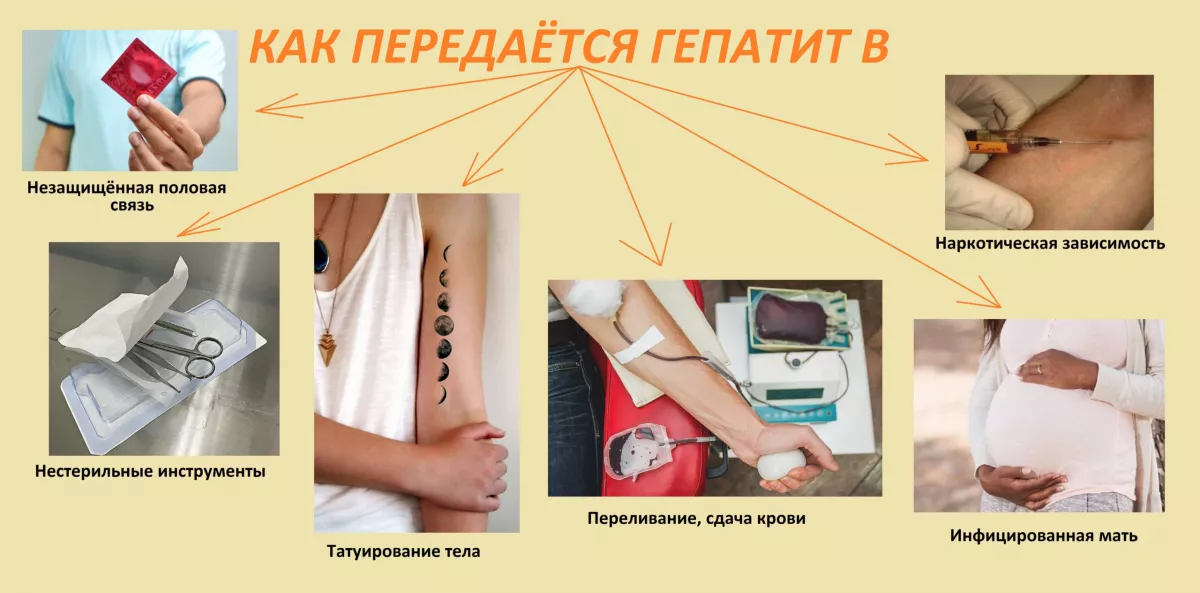 Гепатит С: просто о сложном